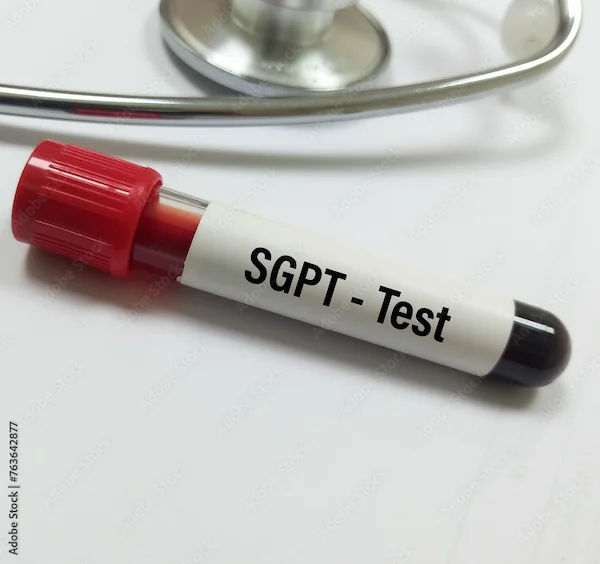 How to Lower SGPT Levels Fast